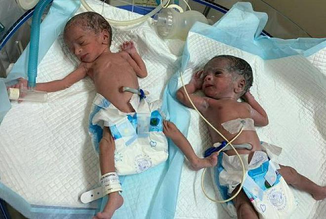 73-year-old Indian woman gives birth to twin girls