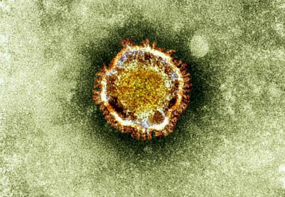 An electron microscope image of a coronavirus, part of a family of viruses that cause ailments including the common cold and SARS.